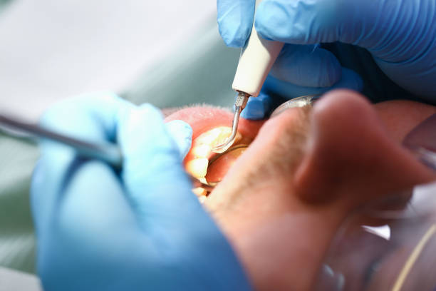 Best Broken Tooth Emergency  in Columbus, MT