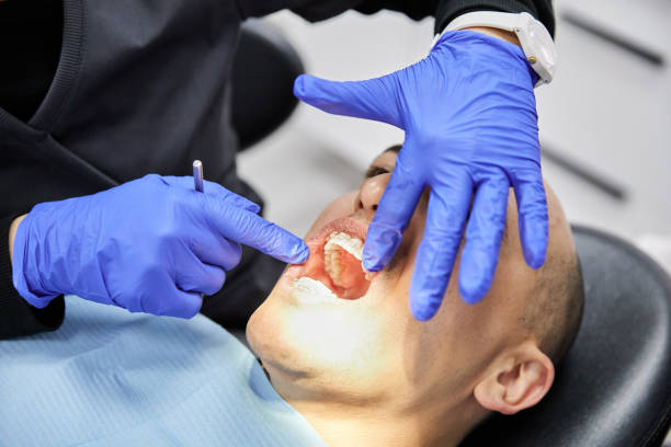 Best Broken Tooth Emergency  in Columbus, MT