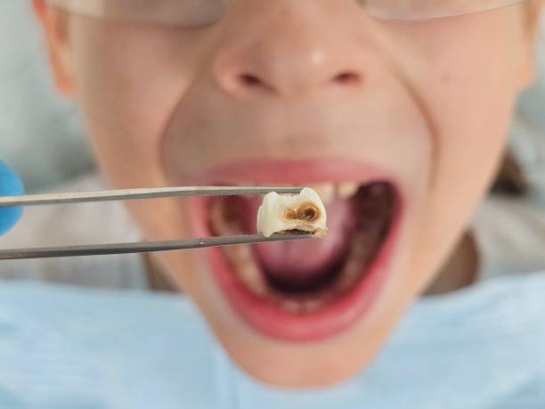 Best Tooth Pain Emergency Relief  in Columbus, MT