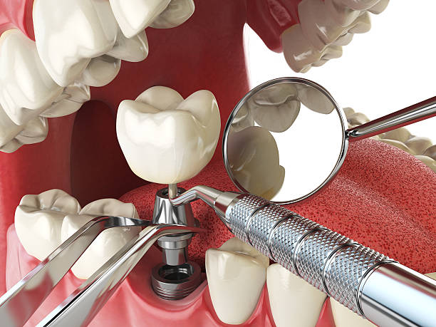 Dentist for Dental Trauma in MT