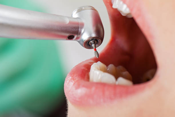 Best Knocked-Out Tooth Emergency  in Columbus, MT